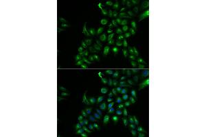 Immunofluorescence analysis of U2OS cells using TSPAN7 antibody.