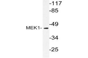 Western blot (WB) analyzes of MEK1 antibody in extracts from Jurkat cells. (MEK1 anticorps)