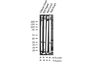 Western blot analysis of Phospho-TNNI3 (Ser43) expression in various lysates (TNNI3 anticorps  (pSer44))