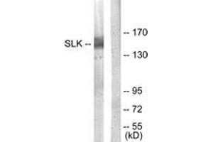 Western blot analysis of extracts from COLO205 cells, using SLK Antibody. (SLK anticorps  (AA 1151-1200))