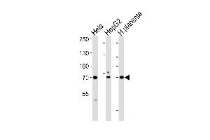 Western blot analysis of lysates from Hela, HepG2 cell line and human placenta tissue lysate (from left to right), using CREBL1Antibody at 1:1000 at each lane. (ATF6B anticorps  (C-Term))