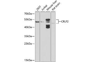 Western blot analysis of extracts of various cell lines, using CRLF2 antibody (ABIN6130231, ABIN6139052, ABIN6139053 and ABIN6214305) at 1:1000 dilution.