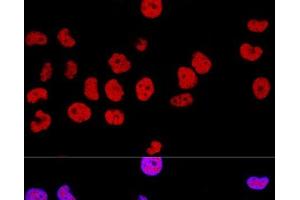 Confocal immunofluorescence analysis of Hela cells using CTCF Polyclonal Antibody at dilution of 1:100.