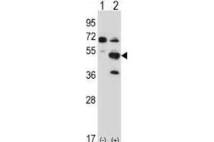 Western Blotting (WB) image for anti-PX domain-containing protein kinase-like protein (PXK) antibody (ABIN2997775) (PXK anticorps)