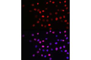 Immunofluorescence analysis of NIH/3T3 cells using Acetyl-Histone H3-K27 Rabbit mAb (ABIN3016650, ABIN3016651, ABIN3016652, ABIN1682513 and ABIN1682514) at dilution of 1:100 (40x lens).