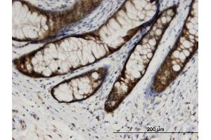 Immunoperoxidase of monoclonal antibody to CMPK1 on formalin-fixed paraffin-embedded human colon.