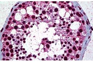 Human Testis: Formalin-Fixed, Paraffin-Embedded (FFPE) (Retinoblastoma Binding Protein 4 anticorps  (AA 1-426))