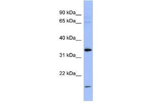 WB Suggested Anti-PYCR1 Antibody Titration: 0.