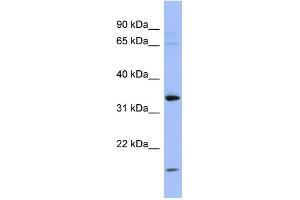 WB Suggested Anti-PYCR1 Antibody Titration: 0. (PYCR1 anticorps  (Middle Region))