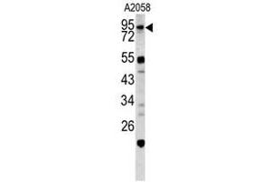 Image no. 1 for anti-Caldesmon 1 (CALD1) (Middle Region) antibody (ABIN452795) (Caldesmon anticorps  (Middle Region))