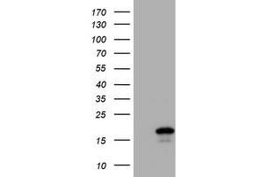 Image no. 1 for anti-Cystatin SA (CST2) antibody (ABIN1497761) (CST2 anticorps)