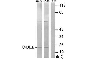 Western Blotting (WB) image for anti-Cell Death-Inducing DFFA-Like Effector B (CIDEB) (Internal Region) antibody (ABIN1850417) (CIDEB anticorps  (Internal Region))