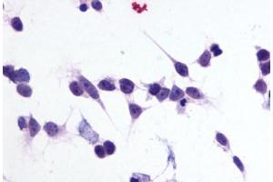 Image no. 2 for anti-Purinergic Receptor P2Y, G-Protein Coupled, 1 (P2RY1) (C-Term) antibody (ABIN1049199) (P2RY1 anticorps  (C-Term))