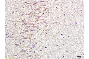 Formalin-fixed and paraffin embedded rat brain labeled with Anti-NPY/Neuropeptide Y Polyclonal Antibody, Unconjugated 1:400 followed by conjugation to the secondary antibody and DAB staining (NPY anticorps  (AA 29-64))