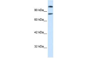 WB Suggested Anti-SREBF2 Antibody Titration:  0. (SREBF2 anticorps  (Middle Region))