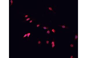 ABIN6266529 staining HeLa cells by IF/ICC. (DP1 anticorps  (C-Term))