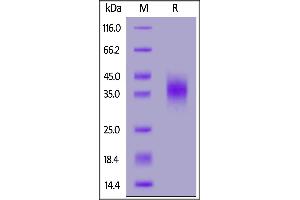 Fed Human CD47, His Tag on  under reducing (R) condition.