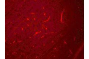 anti-SIK Family Kinase 3 (SIK3) (C-Term) antibody