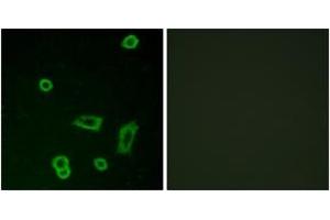 Immunofluorescence analysis of LOVO cells, using MTR1L Antibody. (GPR50 anticorps  (AA 301-350))