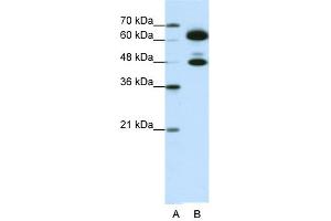 WB Suggested Anti-SNRP70 Antibody Titration:  0. (SNRNP70 anticorps  (C-Term))
