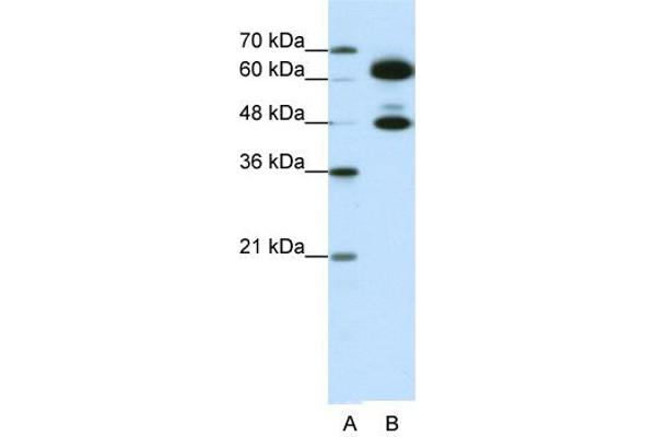 SNRNP70 抗体  (C-Term)