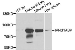 Western blot analysis of extracts of various cell lines, using IVNS1ABP antibody (ABIN5972499) at 1/1000 dilution. (IVNS1ABP anticorps)