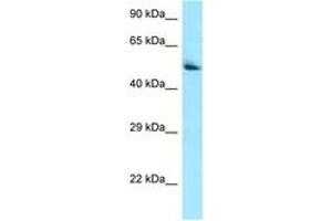 Image no. 1 for anti-Pantothenate Kinase 2 (PANK2) (AA 459-508) antibody (ABIN6748470) (PANK2 anticorps  (AA 459-508))