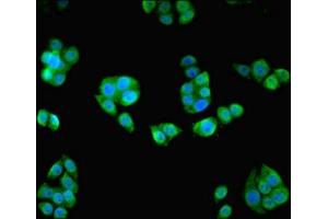 Immunofluorescent analysis of PC-3 cells using ABIN7154838 at dilution of 1:100 and Alexa Fluor 488-congugated AffiniPure Goat Anti-Rabbit IgG(H+L)