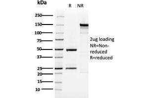 SDS-PAGE Analysis Purified Cytokeratin 5 Mouse Monoclonal Antibody (KRT5/3594).