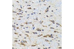 Immunohistochemistry of paraffin-embedded mouse spinal cord using CDK1 antibody.