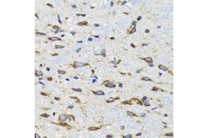 Immunohistochemistry of paraffin-embedded mouse spinal cord using CDK1 antibody. (CDK1 anticorps  (AA 208-258))
