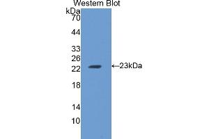 Detection of Recombinant FTH, Rat using Polyclonal Antibody to Ferritin, Heavy Polypeptide (FTH) (FTH1 anticorps)
