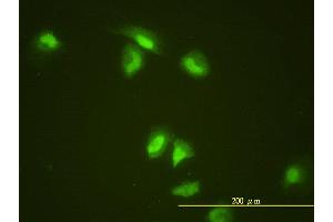 Immunofluorescence of monoclonal antibody to SLBP on HeLa cell. (SLBP anticorps  (AA 1-270))
