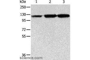Western blot analysis of PC3 cell, human colon cancer and liver cancer tissue, using HSPH1 Polyclonal Antibody at dilution of 1:500 (HSPH1 anticorps)