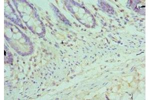 Immunohistochemistry of paraffin-embedded human colon tissue using ABIN7172504 at dilution of 1:100 (DP1 anticorps  (AA 1-290))
