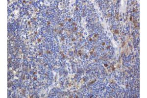 Image no. 1 for anti-Mast/stem Cell Growth Factor Receptor (KIT) (AA 546-976) antibody (ABIN1491586)