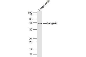 Mouse Lymph node lysates probed with Langerin Polyclonal Antibody, Unconjugated  at 1:300 dilution and 4˚C overnight incubation. (CD207 anticorps  (AA 161-260))