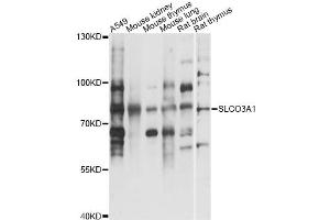 Western blot analysis of extracts of various cell lines, using SLCO3A1 antibody (ABIN6293704) at 1:3000 dilution.