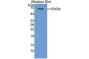 Western blot analysis of recombinant Human TPO.