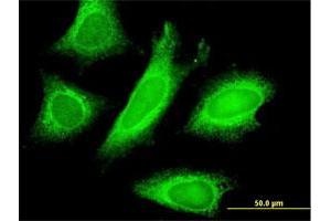 Immunofluorescence of monoclonal antibody to STAU1 on HeLa cell. (STAU1/Staufen anticorps  (AA 401-496))