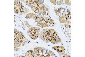 Immunohistochemistry of paraffin-embedded human stomach using CHIC2 antibody (ABIN5974773) at dilution of 1/100 (40x lens). (CHIC2 anticorps)