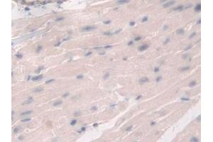 Detection of DDX58 in Mouse Heart Tissue using Polyclonal Antibody to Probable ATP-dependent RNA Helicase DDX58 (DDX58) (DDX58 anticorps  (AA 1-211))