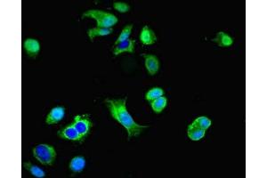 Immunofluorescent analysis of MCF-7 cells using ABIN7149644 at dilution of 1:100 and Alexa Fluor 488-congugated AffiniPure Goat Anti-Rabbit IgG(H+L) (GRID2IP anticorps  (AA 35-156))