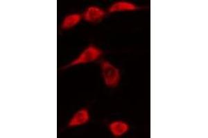 ABIN6276303 staining  Hela cells by IF/ICC. (DDIT3 anticorps  (N-Term))