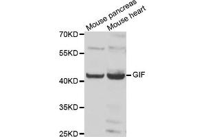 Western blot analysis of extracts of various cell lines, using GIF antibody. (Intrinsic Factor anticorps)