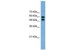 Western Blot showing PGM1 antibody used at a concentration of 1. (Phosphoglucomutase 1 anticorps  (Middle Region))