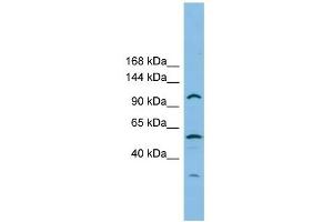 CHTF18 antibody used at 1 ug/ml to detect target protein. (CTF18 anticorps)