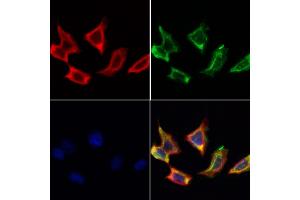 ABIN6259603 and ABIN6274618 staining Hela cells by IF/ICC. (CDKAL1 anticorps  (N-Term))