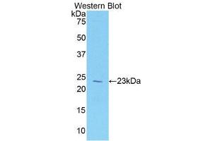 Western Blotting (WB) image for anti-Vitamin D-Binding Protein (GC) (AA 18-211) antibody (ABIN1078666)