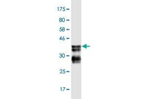 Western Blot detection against Immunogen (36. (BCL9 anticorps  (AA 1036-1135))